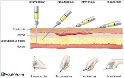 سعر دواء reiferon 3m.i.u. vial s.c/i.m injection